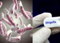 Shigella outbreak Wayanad